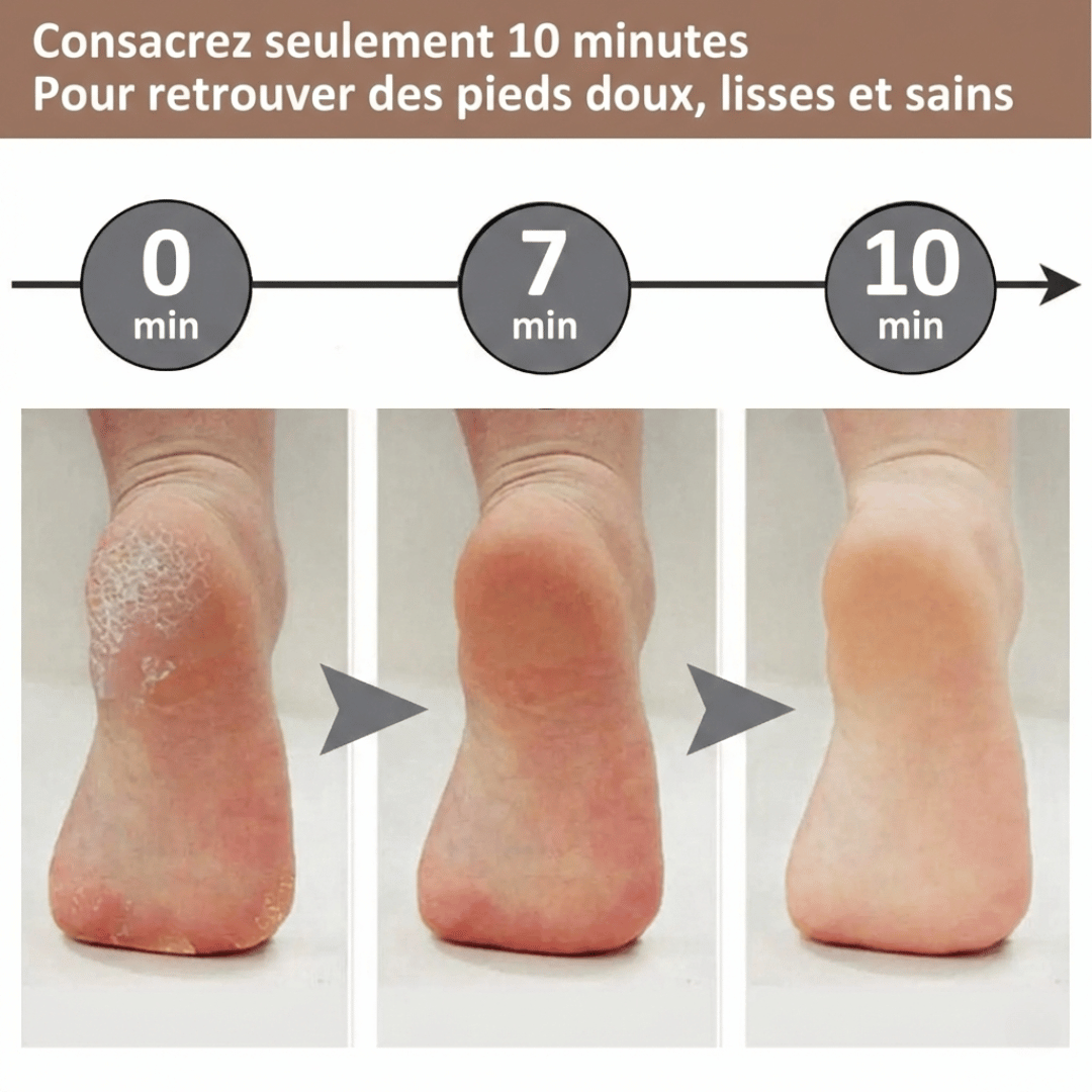 Râpe à pieds électrique rechargeable