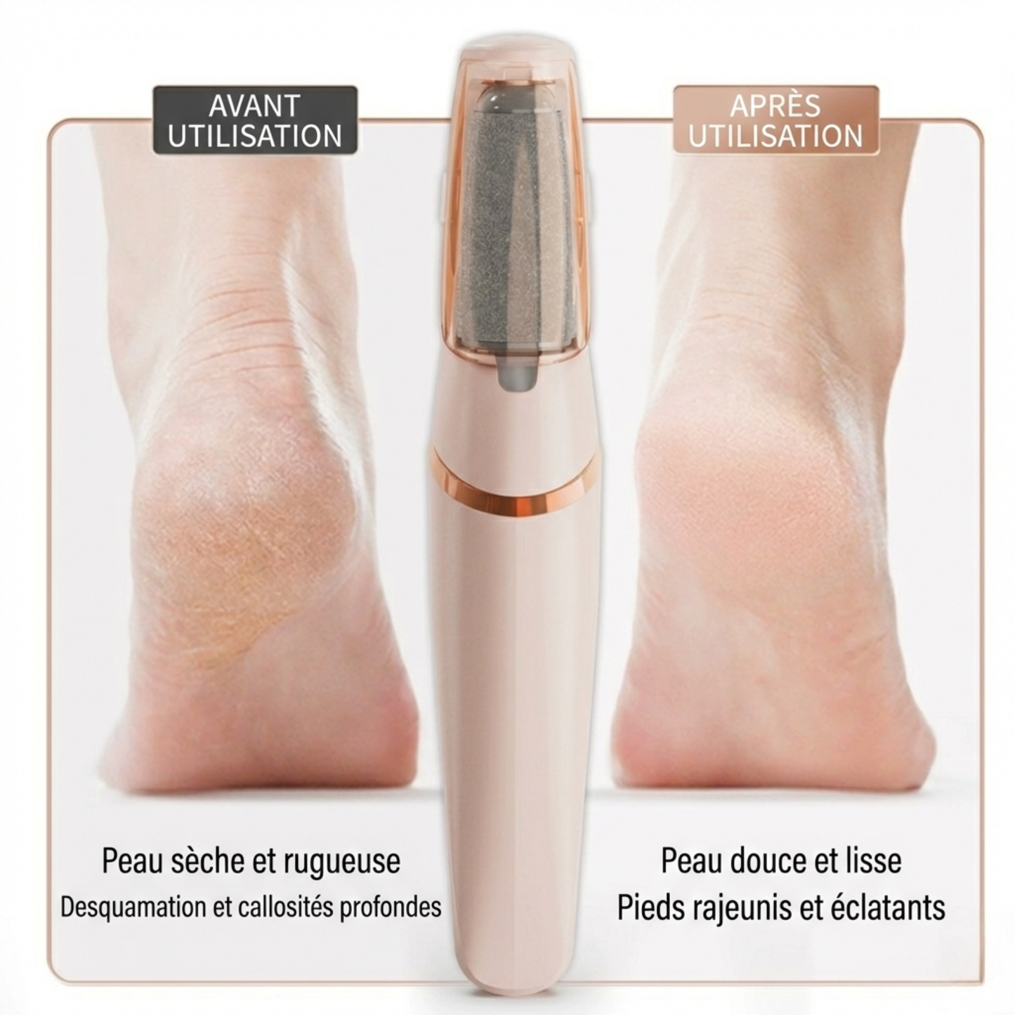 Râpe à pieds électrique rechargeable