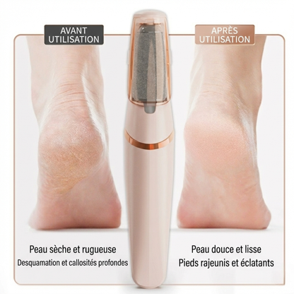 Râpe à pieds électrique rechargeable