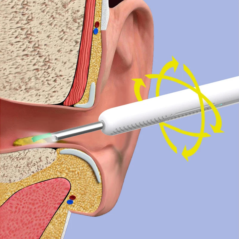 Nettoyeur d'oreilles visuel haute précision