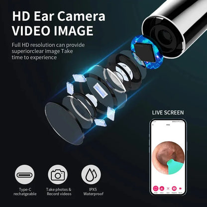NE28 Pro™ – Kit Professionnel de Nettoyage des Oreilles avec Caméra HD 1080P et Connexion WiFi