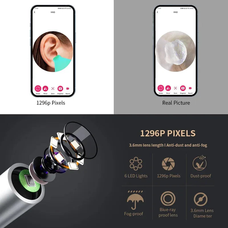 NE28 Pro™ – Kit Professionnel de Nettoyage des Oreilles avec Caméra HD 1080P et Connexion WiFi